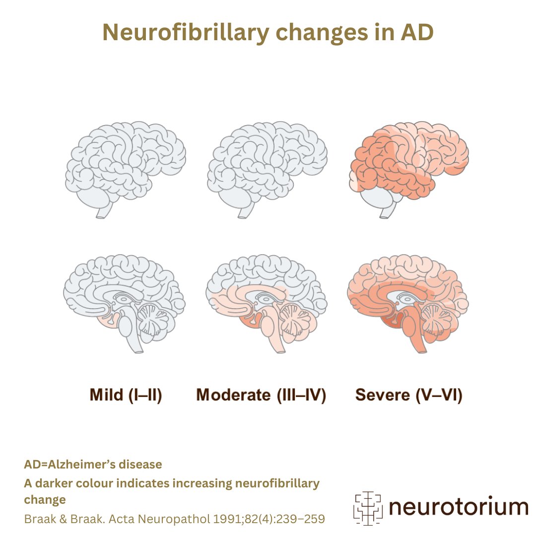 Neurofibrillary changes