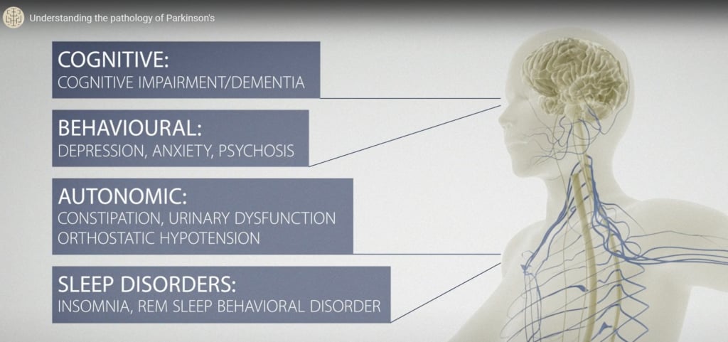 Understanding the Pathology of Parkinson’s Disease