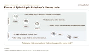 Phases of Aβ buildup in Alzheimer’s disease brain