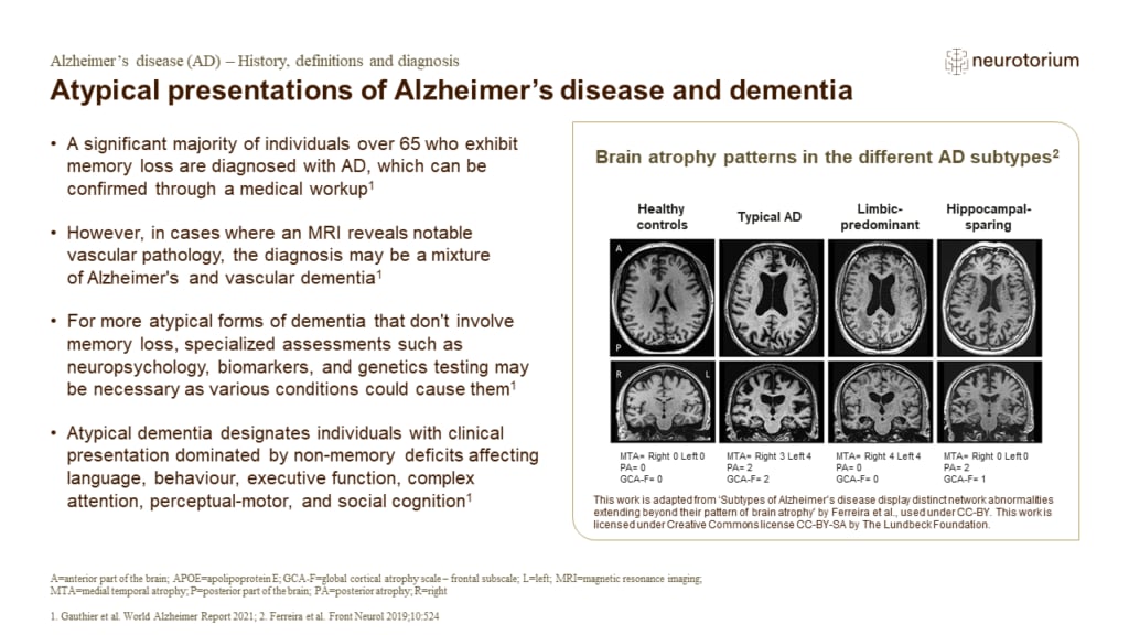 Atypical presentations of Alzheimer’s disease and dementia
