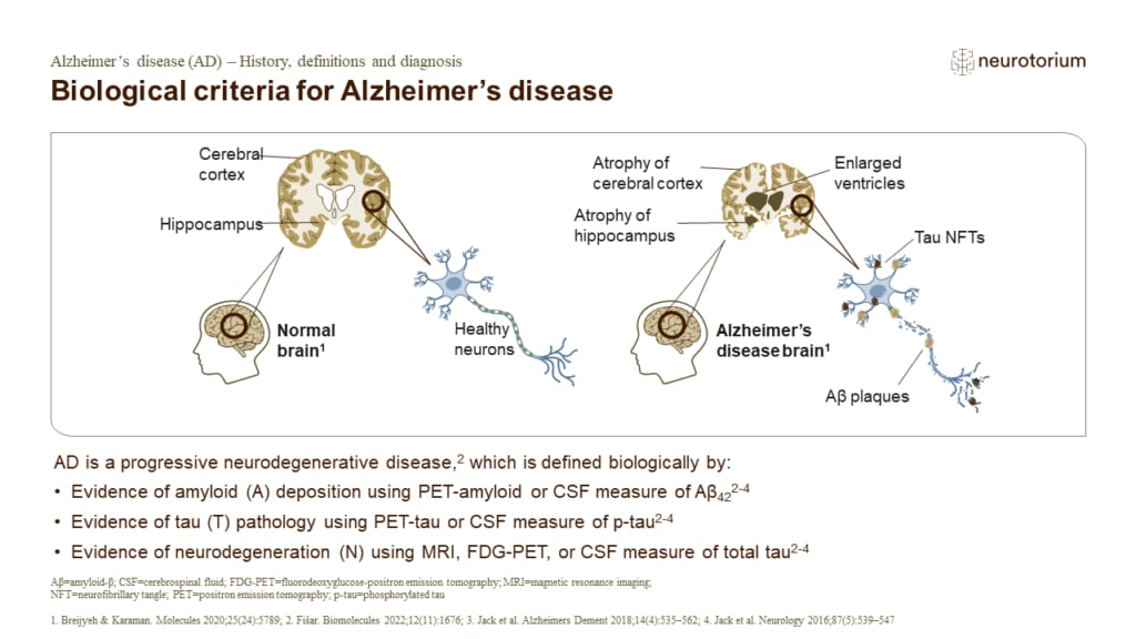 Biological criteria for Alzheimer’s disease