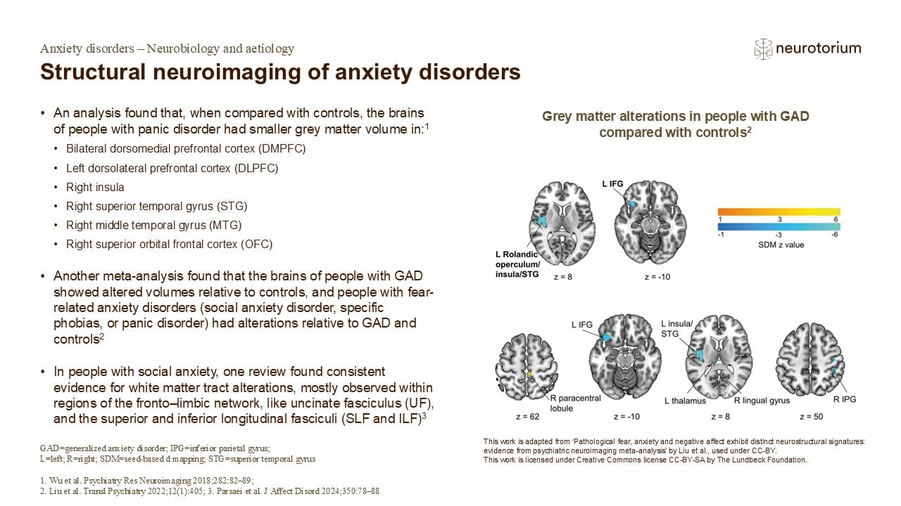 Structural neuroimaging of anxiety disorders