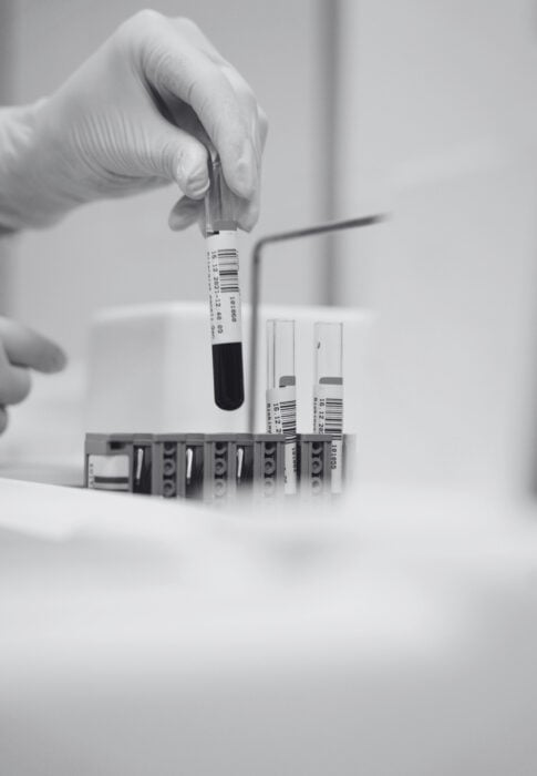 Article cover image showing blood samples and a hand