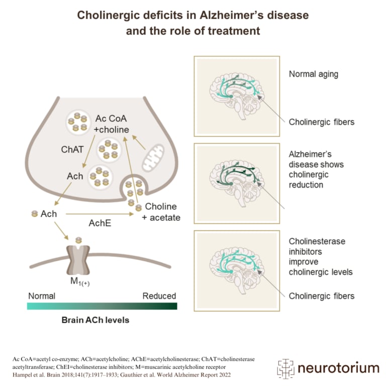 Cholinergic deficits in Alzheimer’s disease