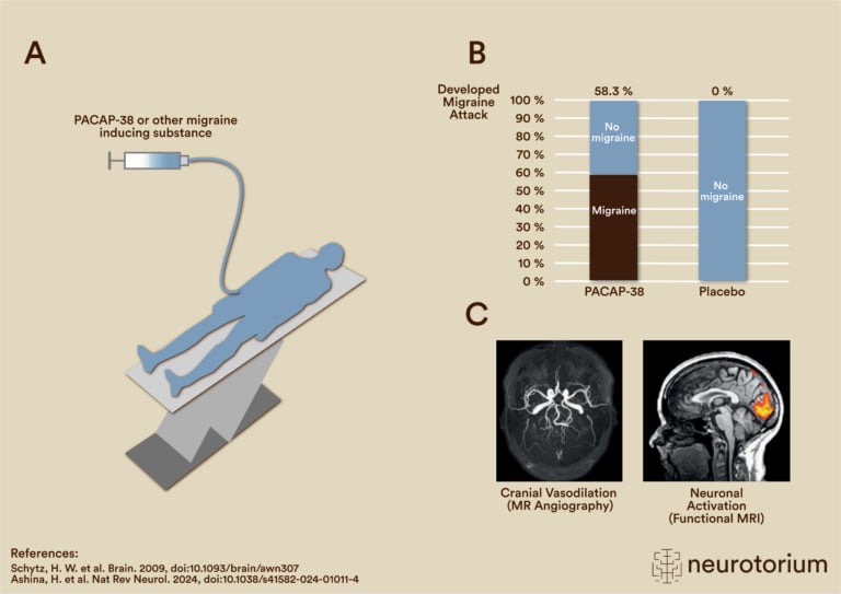 Human models of migraine