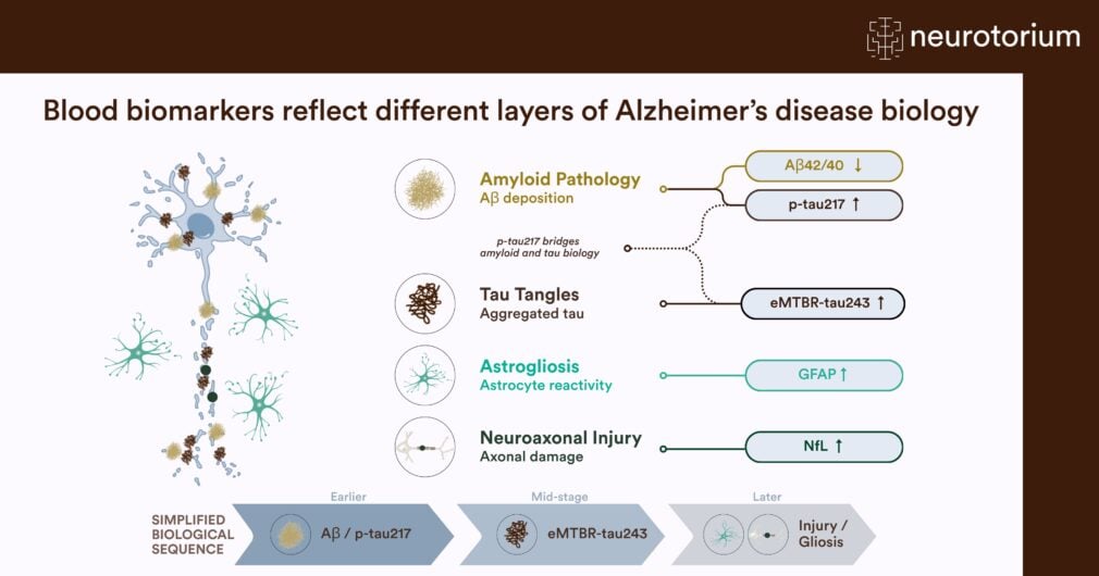 Overview of Alzheimer's disease biomarkers, illustrating disease stages and associated blood marker changes