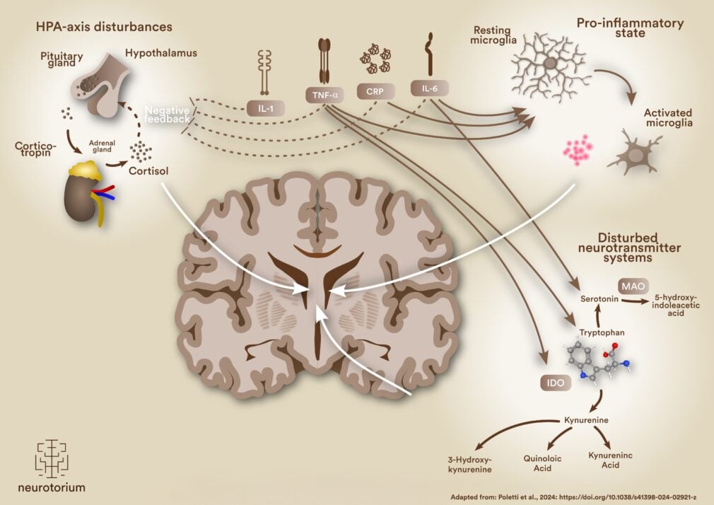 Infographic of immune activation in the brain, focusing on the HPA axis, cytokines, microglia, and disturbances in serotonin and kynurenine metabolism.