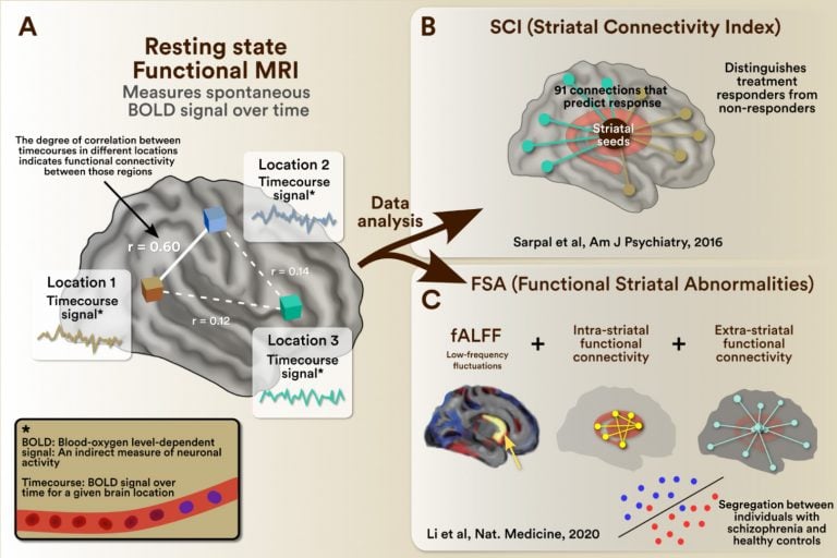 Exemplars of clinically useful biomarkers of Schizophrenia