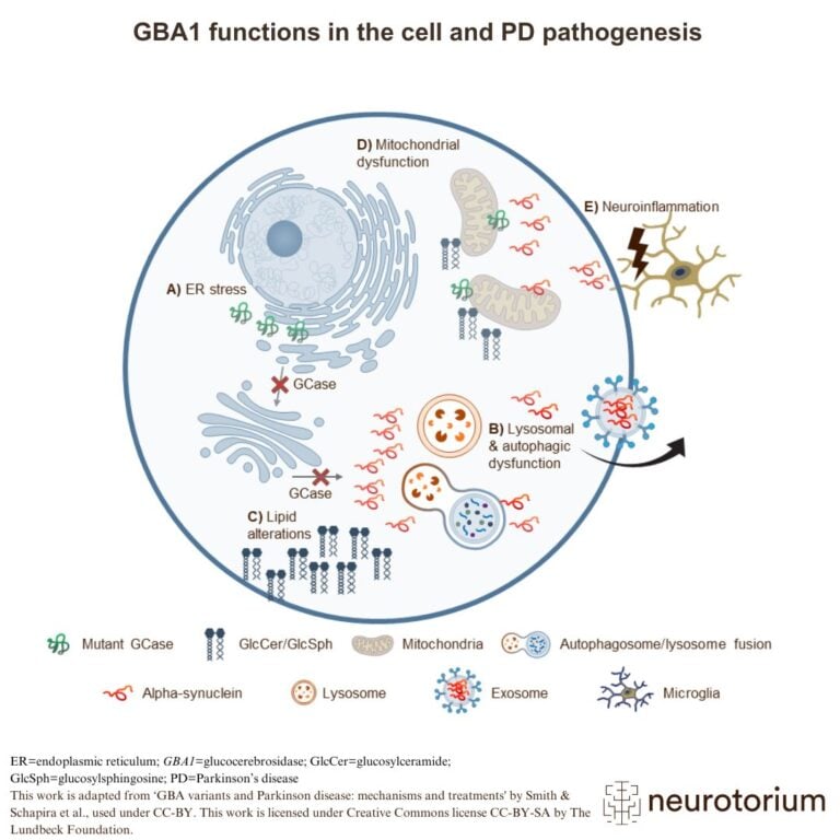 Illustration of cellular mechanisms involved in GBA1 mutations and their role in Parkinson’s disease, including ER stress, lysosomal dysfunction, lipid alterations, mitochondrial dysfunction, and neuroinflammation. Created for educational use on Neurotorium.org.