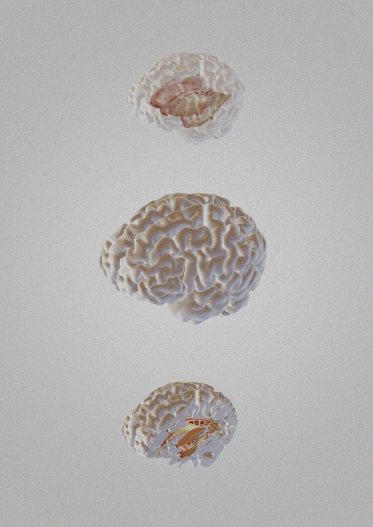 Three cross-sectional brain views showing internal brain structures within the cortex, displayed from different anatomical planes.