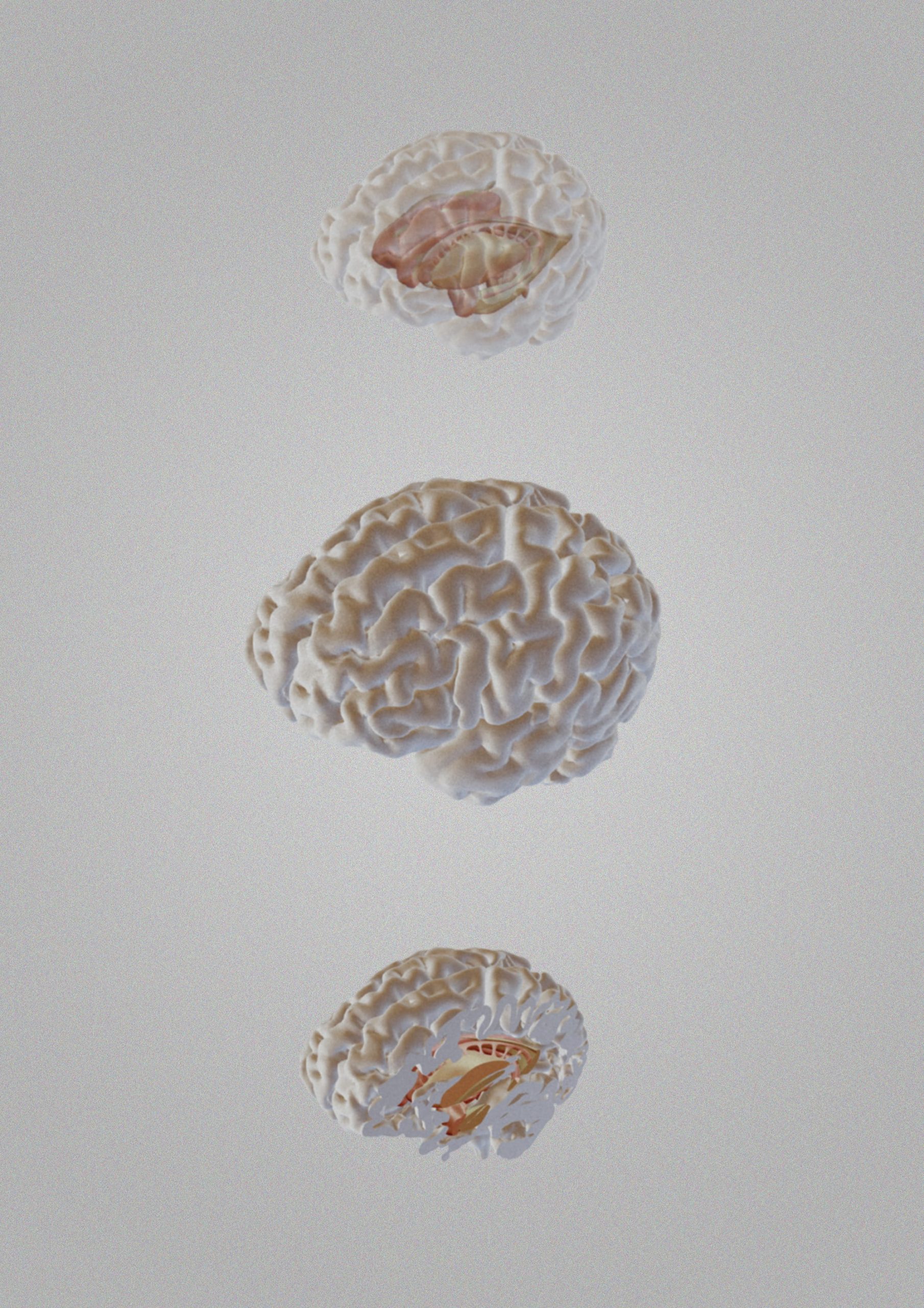 Three cross-sectional brain views showing internal brain structures within the cortex, displayed from different anatomical planes.