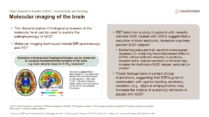 Molecular imaging of the brain