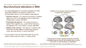 Neurofunctional alterations in MDD