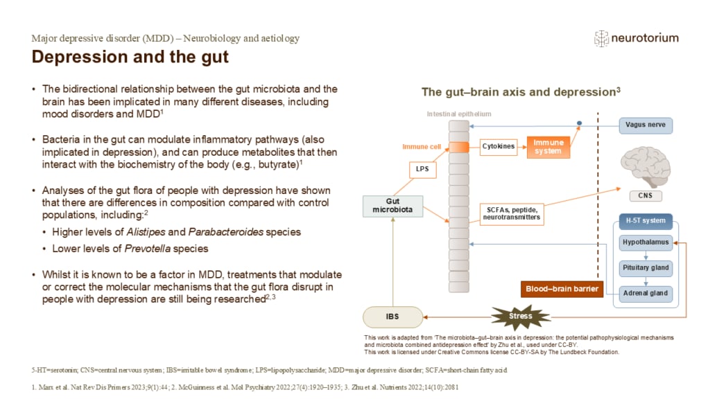 Depression and the gut