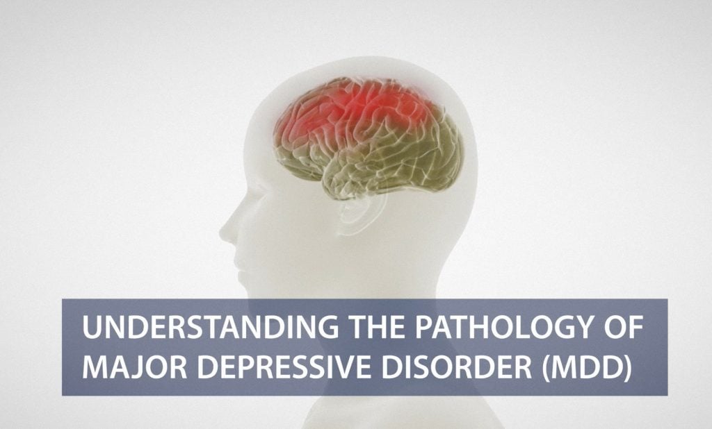 Understanding Disease Pathology of Major Depressive Disorders