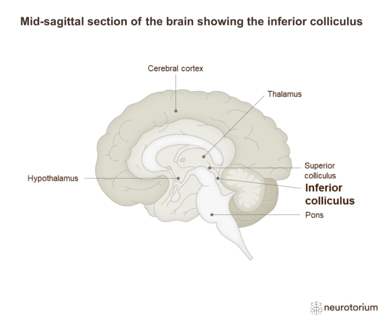 Mid-sagittal diagram of the brain highlighting the inferior colliculus in the midbrain region