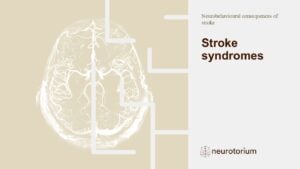 Neurobehavioural consequences of stroke - Stroke syndromes