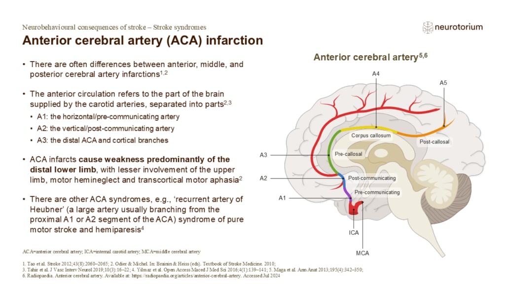 There are often differences between anterior, middle, and posterior cerebral artery infarctions