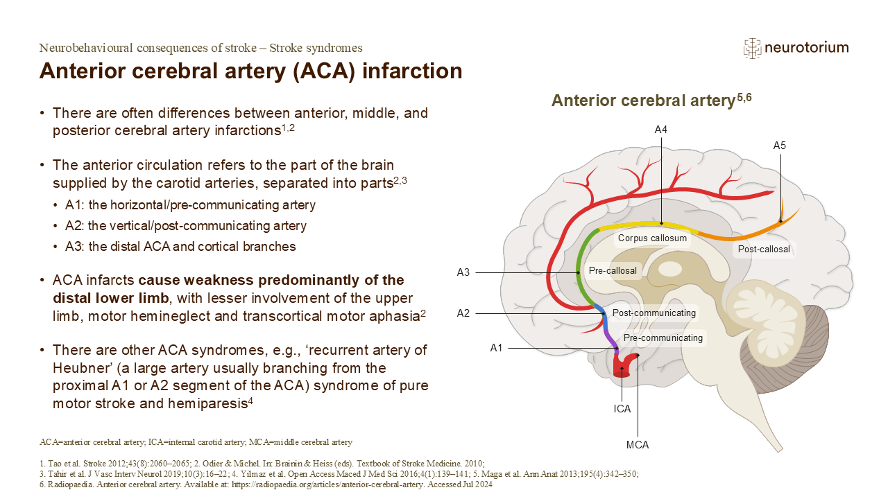 There are often differences between anterior, middle, and posterior cerebral artery infarctions