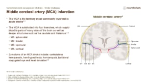 The Middle cerebral artery (MCA) infarction is the territory most commonly involved in acute stroke