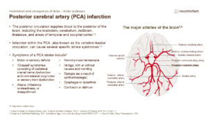 Posterior cerebral artery (PCA) infarction