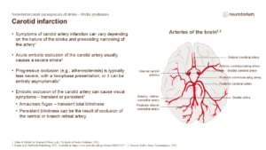 Carotid infarction