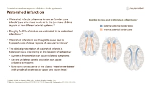 Watershed infarction