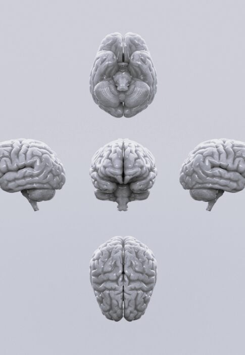 Cover image for article showing the brain in BW
