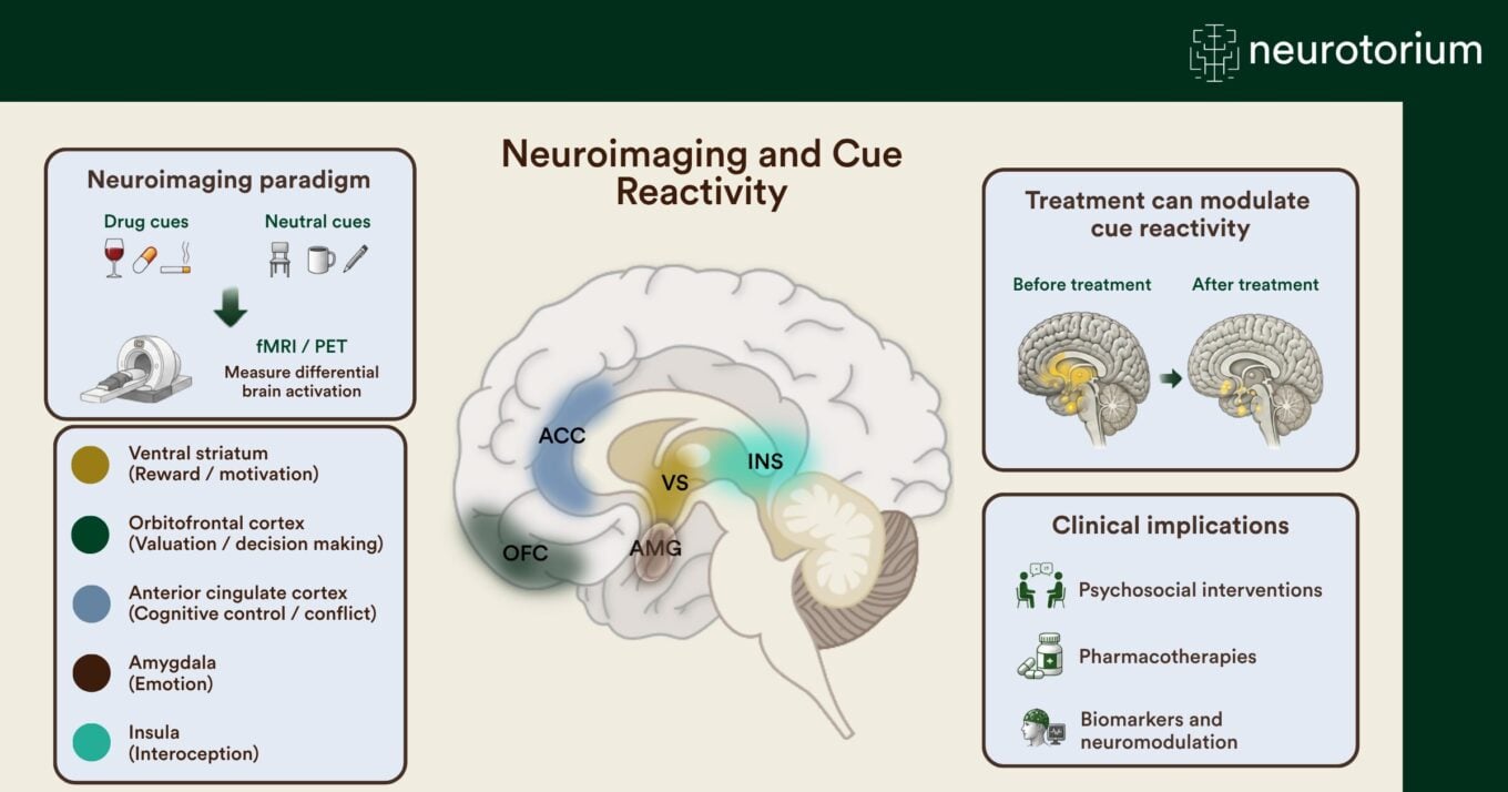 Image showing neuroimaging and cue reactivity.