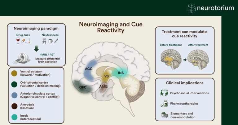 Image showing neuroimaging and cue reactivity.