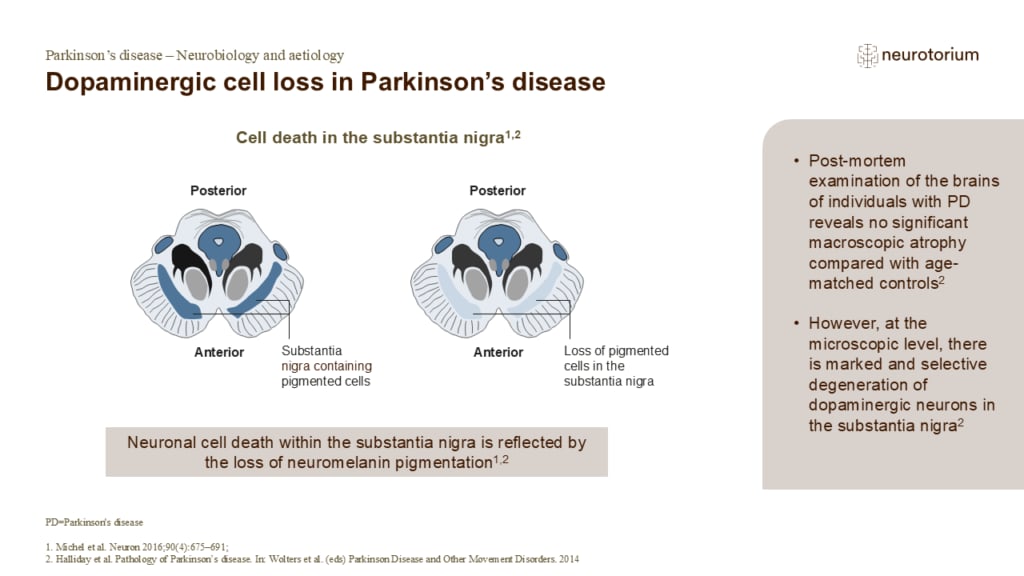 Dopaminergic cell loss in Parkinson’s disease