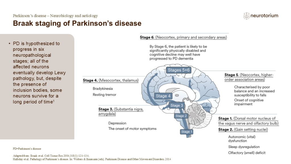 Braak staging of Parkinson’s disease