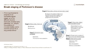 Braak staging of Parkinson’s disease