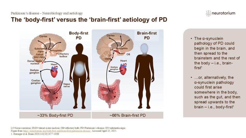 The ‘body-first’ versus the ‘brain-first’ aetiology of PD
