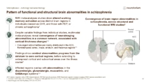 Slide showing converging structural and functional brain abnormalities in schizophrenia across frontal, cingulate, insular, and striatal regions.