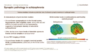 Slide showing evidence of reduced synaptic density and synaptic markers in schizophrenia.