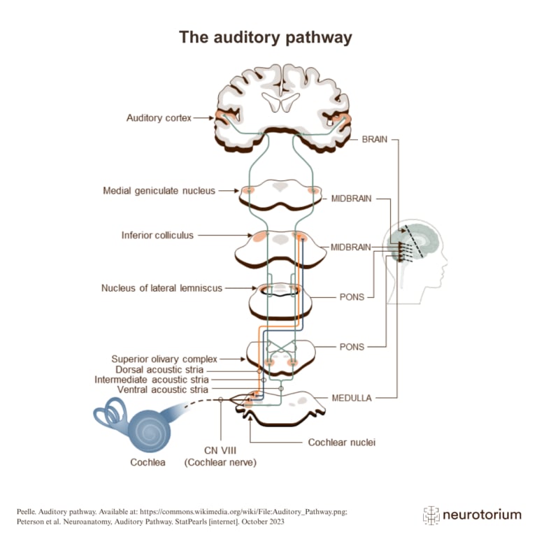 Figure of the auditory pathway from the cochlea through brainstem nuclei to the auditory cortex.
