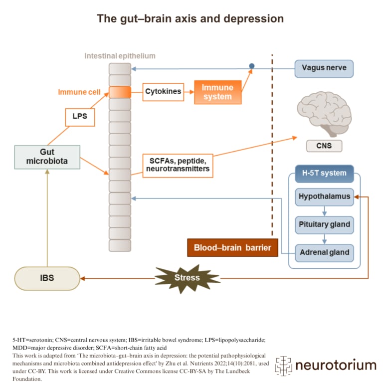 Illustration of how gut microbiota, immune responses, and neurotransmitters interact with the brain via the vagus nerve and blood–brain barrier in depression.