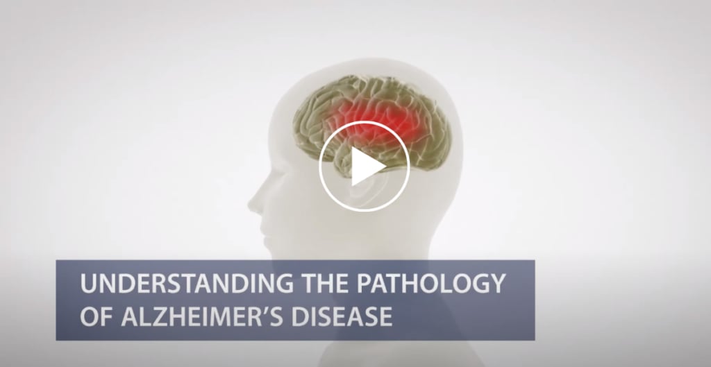 Understanding the Pathology of Alzheimer’s Disease