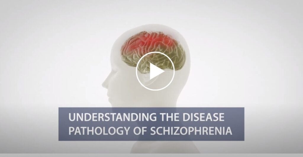 Understanding the Pathology of Schizophrenia