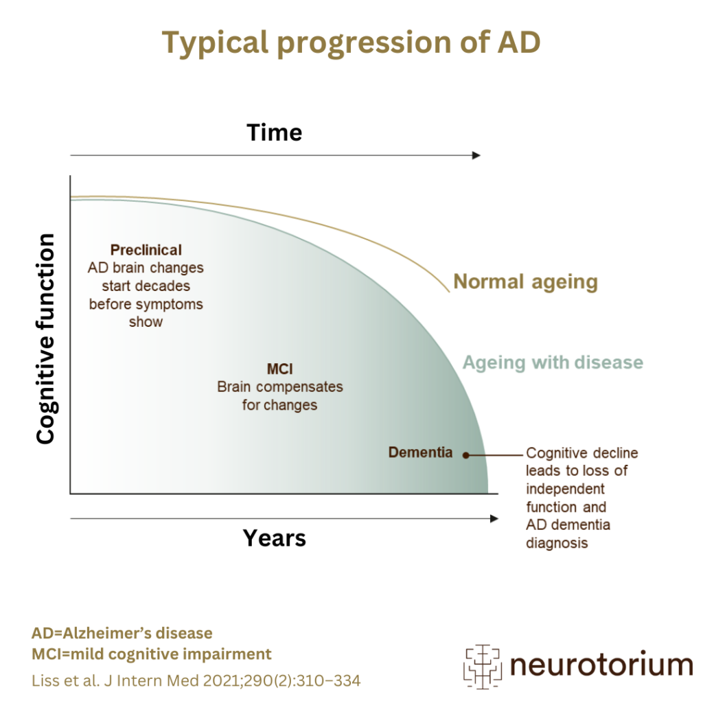 Typical progression of Alzheimer’s disease