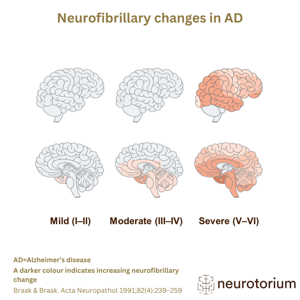 Neurofibrillary changes