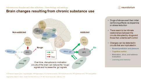 Substance use disorders and other addictions – Neurobiology and aetiology – slide9