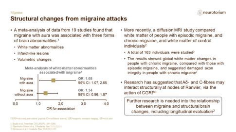 Migraine 3 Neurobiology And Aetiology Slide 22