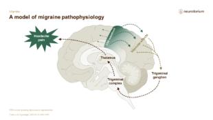 Migraine 3 Neurobiology And Aetiology Slide 24
