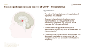 Migraine pathogenesis and the role of CGRP – hypothalamus