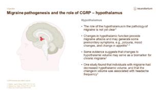 Migraine 3 Neurobiology And Aetiology Slide 30