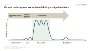 Various brain regions are activated during a migraine attack