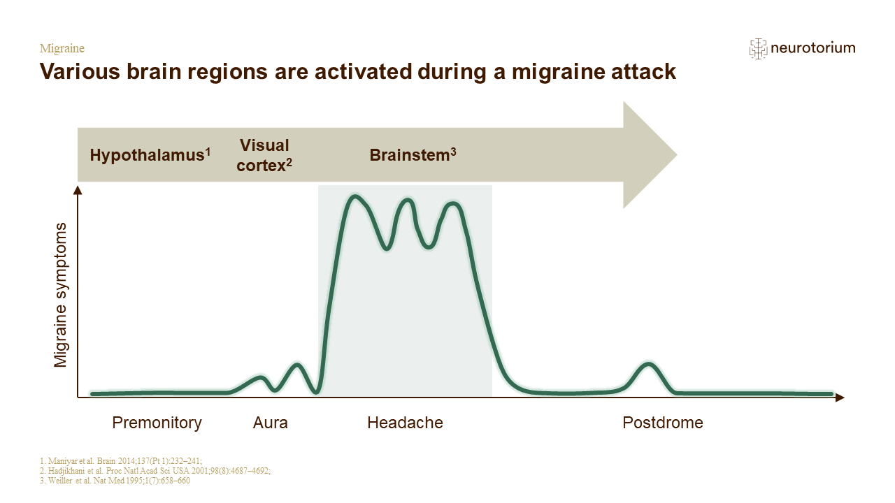 Migraine 3 Neurobiology And Aetiology Slide 31