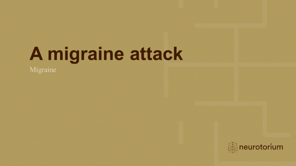 A migraine attack